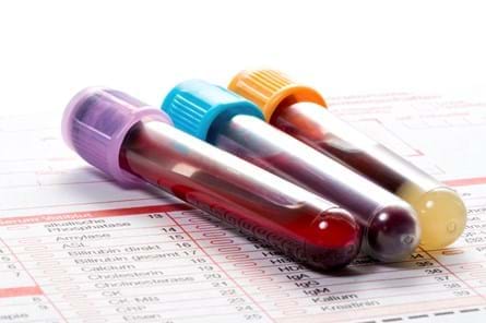 Blood test - training adaptations & health screen